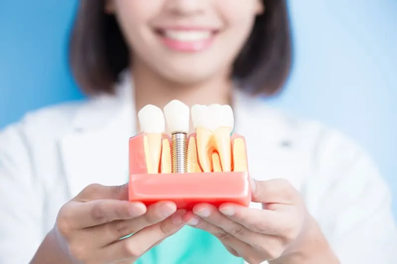 Profesional sosteniendo un modelo dental para explicar un tratamiento en la Clínica Dentalbeth