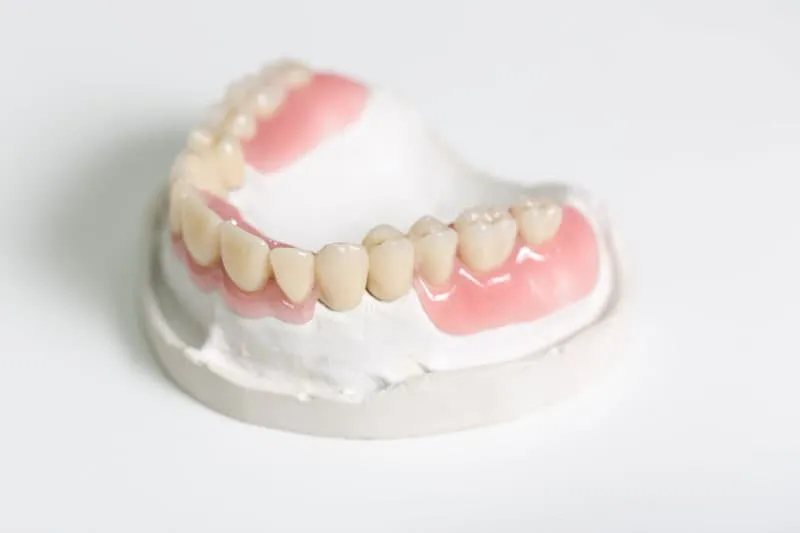 Prótesis dental removible sobre un modelo de escayola en la Clínica Dentalbeth